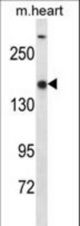 SET1B Antibody western blot of mouse heart tissue lysates (35 ug/lane). The SET1B antibody detected the SET1B protein (arrow).