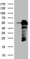 HEK293T cells were transfected with the pCMV6-ENTRY control (Left lane) or pCMV6-ENTRY SETD2 (Right lane) cDNA for 48 hrs and lysed. Equivalent amounts of cell lysates (5 ug per lane) were separated by SDS-PAGE and immunoblotted with anti-SETD2.