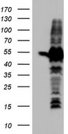 HEK293T cells were transfected with the pCMV6-ENTRY control (Left lane) or pCMV6-ENTRY SETD2 (Right lane) cDNA for 48 hrs and lysed. Equivalent amounts of cell lysates (5 ug per lane) were separated by SDS-PAGE and immunoblotted with anti-SETD2.
