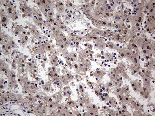 IHC of paraffin-embedded Human embryonic liver tissue using anti-SETD2 mouse monoclonal antibody. (Heat-induced epitope retrieval by 1 mM EDTA in 10mM Tris, pH8.5, 120°C for 3min).