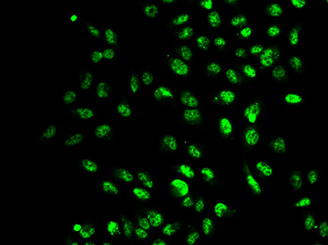 Immunofluorescence analysis of A549 cell using SETD2 antibody.