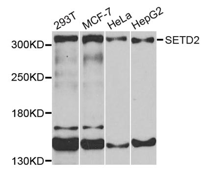Western blot analysis of extracts of various cells, using SETD2 antibody.