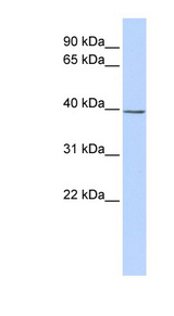 SETD3 antibody LS-C102384 Western blot of Jurkat lysate.
