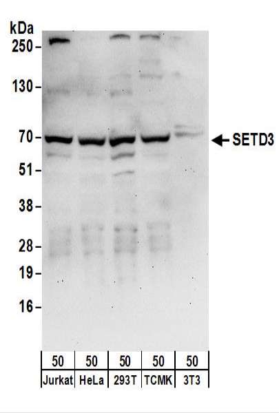 Detection of Human and Mouse SETD3 by Western Blot. Samples: Whole cell lysate (50 ug) from Jurkat, HeLa, 293T, mouse TCMK-1, and mouse NIH3T3 cells. Antibodies: Affinity purified rabbit anti-SETD3 antibody used for WB at 0.1 ug/ml. Detection: Chemiluminescence with an exposure time of 1 minute.