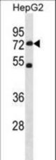 SETD3 Antibody western blot of HepG2 cell line lysates (35 ug/lane). The SETD3 antibody detected the SETD3 protein (arrow).