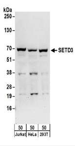 Detection of Human SETD3 by Western Blot. Samples: Whole cell lysate (50 ug) from Jurkat, HeLa, and 293T cells. Antibodies: Affinity purified rabbit anti-SETD3 antibody used for WB at 0.1 ug/ml. Detection: Chemiluminescence with an exposure time of 30 seconds.