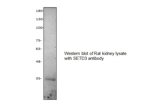 Western blot of SETD3 antibody LS-X234961.