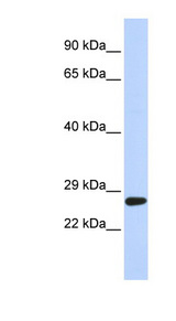 SETD4 antibody LS-C101505 Western blot of 721_B cell lysate.