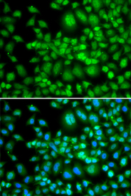 Immunofluorescence blot of MCF7 cell using SETD5 antibody. Blue: DAPI for nuclear staining.