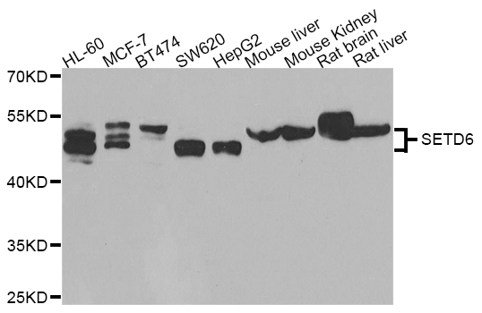 Western blot blot of extracts of various cell lines, using SETD6 antibody.