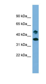 SETD6 antibody LS-C111308 Western blot of THP-1 cell lysate.