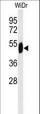 Western blot of SETD6 Antibody in WiDr cell line lysates (35 ug/lane). SETD6 (arrow) was detected using the purified antibody.