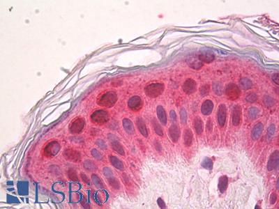 Anti-SETD7 / SET7 antibody IHC of human skin. Immunohistochemistry of formalin-fixed, paraffin-embedded tissue after heat-induced antigen retrieval. Antibody LS-B8443 dilution 5 ug/ml.
