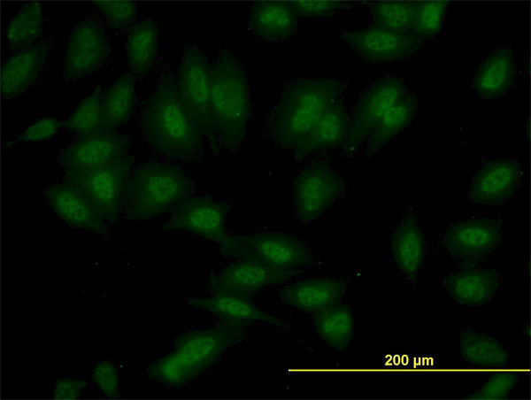 Immunofluorescence of monoclonal antibody to SET7 on HeLa cell. [antibody concentration 10 ug/ml]