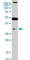 SET7 monoclonal antibody (M01), clone 5B4 Western blot of SET7 expression in Jurkat.