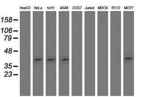 Western blot of extracts (35 ug) from 9 different cell lines by using anti-SETD7 monoclonal antibody (HepG2: human; HeLa: human; SVT2: mouse; A549: human; COS7: monkey; Jurkat: human; MDCK: canine; PC12: rat; MCF7: human).