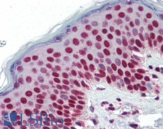 Anti-SETD7 / SET7 antibody IHC of human skin. Immunohistochemistry of formalin-fixed, paraffin-embedded tissue after heat-induced antigen retrieval. Antibody LS-B2921 concentration 5 ug/ml.