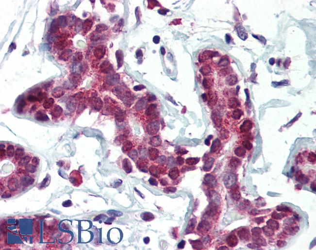 Anti-SETD7 / SET7 antibody IHC of human breast. Immunohistochemistry of formalin-fixed, paraffin-embedded tissue after heat-induced antigen retrieval. Antibody LS-B2921 concentration 5 ug/ml.