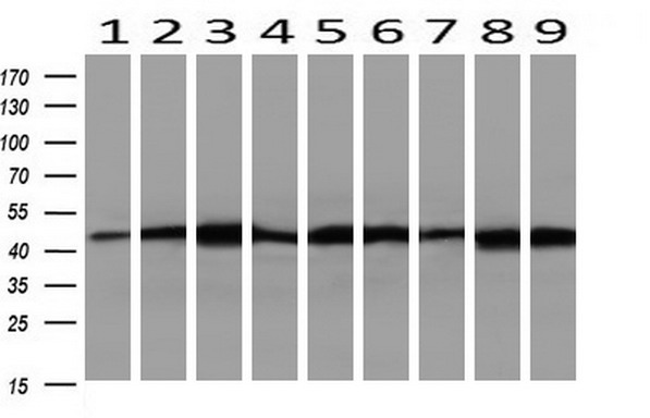 Western blot of extracts (10ug) from 9 Human tissue by using anti-SETD7 monoclonal antibody at 1:200 (1: Testis; 2: Omentum; 3: Uterus; 4: Breast; 5: Brain; 6: Liver; 7: Ovary; 8: Thyroid gland; 9: colon).