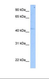 Fetal pancreas cell lysate. Antibody concentration: 5.0 ug/ml. Gel concentration: 12%.