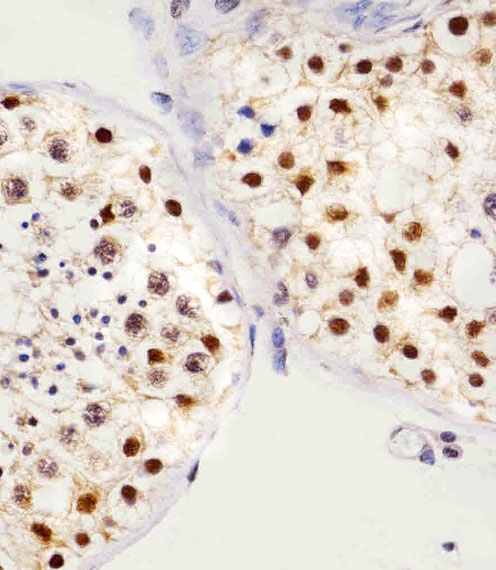 Immunohistochemical of paraffin-embedded H. testis section using SET07 Antibody. Antibody was diluted at 1:25 dilution. A peroxidase-conjugated goat anti-rabbit IgG at 1:400 dilution was used as the secondary antibody, followed by DAB staining.