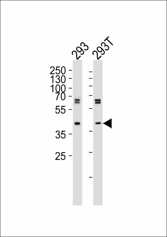Western blot of lysates from 293, 293T cell line (from left to right) with SET07 Antibody (43AT551. 86. 76). 43AT551. 86. 76 was diluted at 1:1000 at each lane. A goat anti-mouse IgG H&L (HRP) at 1:3000 dilution was used as the secondary antibody. Lysates at 35 ug per lane.
