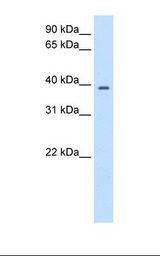 Transfected 293T cell lysate. Antibody concentration: 2.5 ug/ml. Gel concentration: 12%.