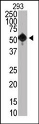 The anti-SET07 antibody is used in Western blot to detect SET07 in 293 cells.