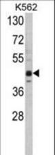 Western blot of SET07 Antibody in K562 cell line lysates (35 ug/lane). SET07 (arrow) was detected using the purified antibody.