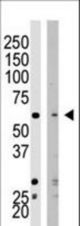 Western blot of SET07 polyclonal antibody in HeLa cell lysate (Lane 1) and NIH/3T3 cell lysate (Lane 2). SET07 (arrow) was detected using purified antibody. Secondary HRP-anti-rabbit was used for signal visualization with chemiluminescence.