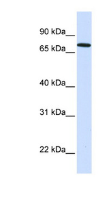 SETDB2 antibody LS-C111208 Western blot of Placenta lysate.