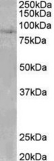 SETDB2 antibody (0.1 ug/ml) staining of Human Heart lysate (35 ug protein in RIPA buffer). Primary incubation was 1 hour. Detected by chemiluminescence.