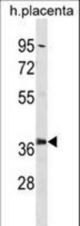 PSMD6 Antibody western blot of human placenta tissue lysates (35 ug/lane). The PSMD6 antibody detected the PSMD6 protein (arrow).