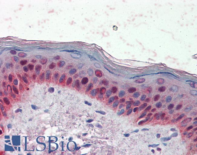 Anti-SF1 antibody IHC of human skin. Immunohistochemistry of formalin-fixed, paraffin-embedded tissue after heat-induced antigen retrieval. Antibody LS-B3095 concentration 10 ug/ml.