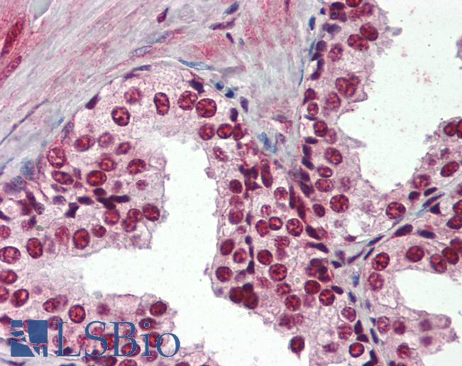 Anti-SF1 antibody IHC of human prostate. Immunohistochemistry of formalin-fixed, paraffin-embedded tissue after heat-induced antigen retrieval. Antibody LS-B3095 concentration 10 ug/ml.