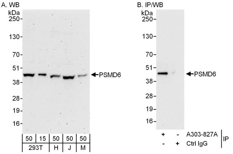 Detection of Human and Mouse PSMD6 by Western Blot (h and m) and Immunoprecipitation (h). Samples: Whole cell lysate from 293T (15 and 50 ug for WB; 1 mg for IP, 20% of IP loaded), HeLa (H; 50 ug), Jurkat (J; 50 ug) and mouse NIH3T3 (M; 50 ug) cells. Antibodies: Affinity purified rabbit anti-PSMD6 antibody used for WB at 0.1 ug/ml (A) and 1 ug/ml (B) and used for IP at 6 ug/mg lysate. Detection: Chemiluminescence with exposure times of 3 minutes (A) and 30 seconds (B).