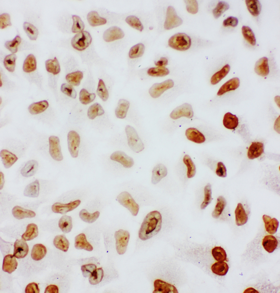 SF1 antibody. ICC: HELA Cell.