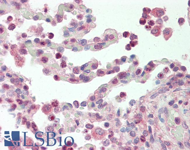 Anti-SF1 antibody IHC staining of human lung. Immunohistochemistry of formalin-fixed, paraffin-embedded tissue after heat-induced antigen retrieval. Antibody LS-B10256 concentration 10 ug/ml.