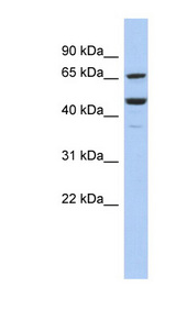 SF1 antibody Western blot of COLO205 cell lysate.