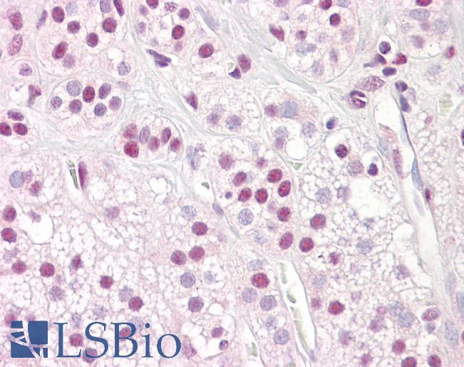 Anti-SF1 antibody IHC of human adrenal. Immunohistochemistry of formalin-fixed, paraffin-embedded tissue after heat-induced antigen retrieval. Antibody LS-B7622 concentration 10 ug/ml.