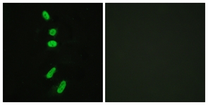 Immunofluorescence of HeLa cells, using SF1 Antibody. The picture on the right is treated with the synthesized peptide.