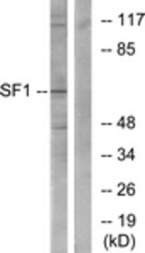 Western blot of extracts from COLO205 cells, using SF1 Antibody. The lane on the right is treated with the synthesized peptide.