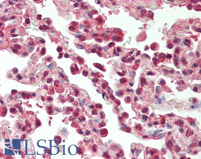 Anti-SF1 antibody IHC staining of human lung. Immunohistochemistry of formalin-fixed, paraffin-embedded tissue after heat-induced antigen retrieval. Antibody LS-B10255 concentration 10 ug/ml.