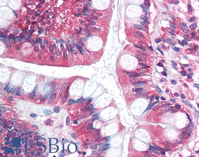 Anti-SF1 antibody IHC of human small intestine. Immunohistochemistry of formalin-fixed, paraffin-embedded tissue after heat-induced antigen retrieval. Antibody LS-B1563 concentration 5 ug/ml.