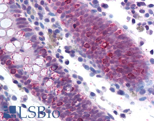 Anti-SF1 antibody IHC of human colon. Immunohistochemistry of formalin-fixed, paraffin-embedded tissue after heat-induced antigen retrieval. Antibody LS-B1563 concentration 5 ug/ml.