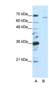 SF1 antibody LS-B1563 Western blot of HepG2 cell lysate.
