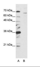 A: Marker, B: HepG2 Cell Lysate