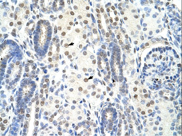 SF1 antibody LS-C31720 was used in IHC to stain formalin-fixed, paraffin-embedded human kidney.