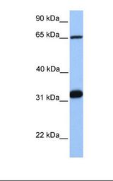 Jurkat cell lysate. Antibody concentration: 1.0 ug/ml. Gel concentration: 12%.