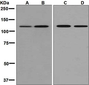 Western blot analysis on (A) lymph node, (B) HeLa, (C) K562, and (D) Raji lysates using anti-SF3A1 antibody.